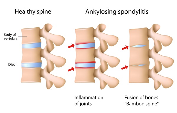 Best Doctor for Rheumatology in Mumbai